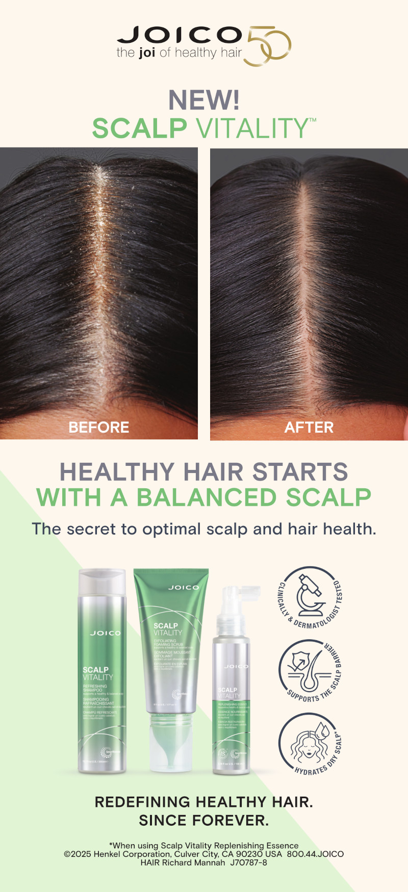 scalp vitality before and after with products