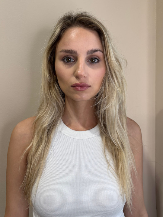 blonde model before treatment